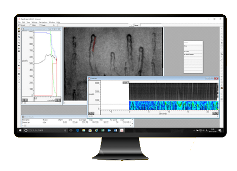 毛細血管画像解析ソフト Capimetrics の画面